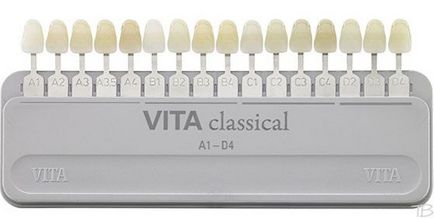 Scale Vita (Vita)