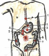 Simptome de ulcere gastrice si duodenale