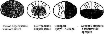 Spitale ale cauzei, simptome, diagnostic și tratament