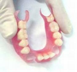 Чи варто вибирати нейлоновий зубний протез відгуки пацієнтів і характеристика