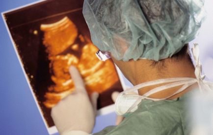 Chistul subcapsular al rinichiului - de ce se formează, principalele căi de eliminare și control