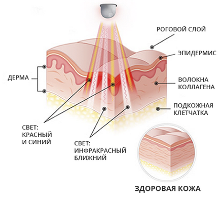 LED маска sidey лице, красота и здрава кожа!