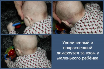 A hőmérsékletet stomatitis gyermekek és felnőttek, mit kell tennie (gyermek) A hőmérsékletet stomatitis gyermekek és felnőttek, mit kell tenni