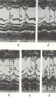 Diagnosticul ultrasonic în cardiologie