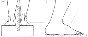 Valgus deformitás a nagylábujj - kezelés, edzés, lézerkezelés