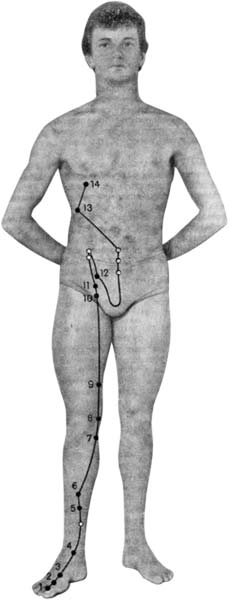 Vezicul vezicii biliare vs. oncologie