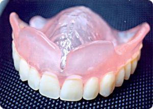 Proteze dentare acrilice din plastic și plusuri, preturi, fotografii