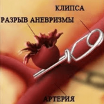 Аневризма судин головного мозку симптоми, лікування, операції при аневризмі