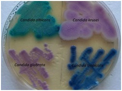 Program de bază pentru tyanshi cu mihalț, folosirea biocorrectorilor împotriva cadidelor fungi