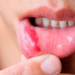 Durerea gingiei în apropierea cauzelor și tratamentului dintelui