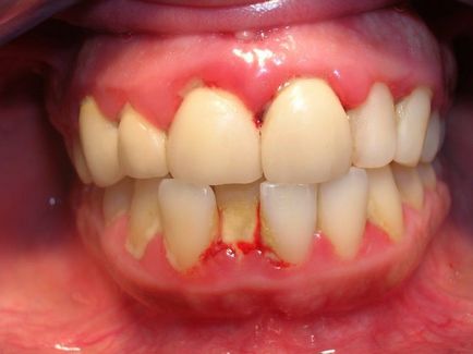 Болить ясна близько зуба причини і лікування