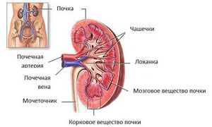 Болить нирка симптоми лікування народними засобами