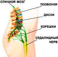 Leg болка - ишиас cimptomy заболяване, лечение на болки в крака