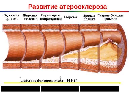 Центр атеросклерозу і порушень ліпідного обміну, клінічна лікарня №122 імені ова федерального