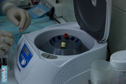 Centrifuga APRF készítésére szolgáló biológiai gyógyulás