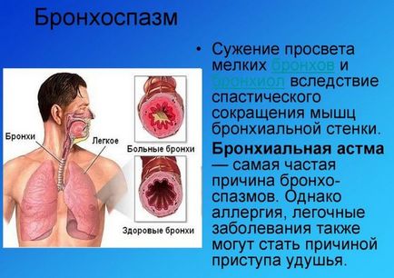 Cum se elimină bronhospasmul la un adult
