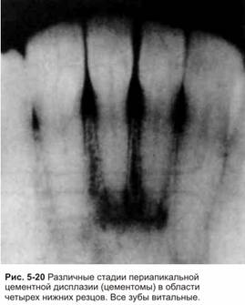 Reading az X-ray endodoncia