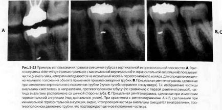 Reading az X-ray endodoncia