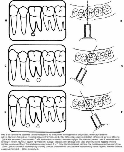 Citirea radiografiilor în endodonție