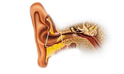 Ce să faci dacă doare și urechește