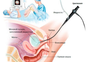 Diagnostic și operații privind metodele vezicii urinare