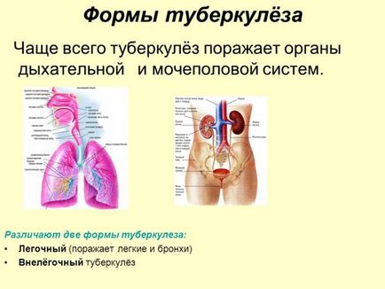 Sunt disponibile informații importante despre modul în care TB este transmisă unei persoane