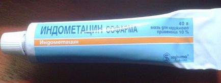 Епікондиліт ліктьового суглоба лікування мазями і народними методами