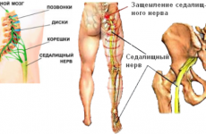 Cauze esențiale de tremor, simptome, tratament