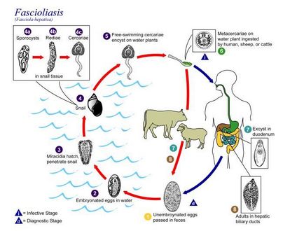 Fasciola (fascioliasis) - clinică, simptome, diagnostic, tratament, paraziți ai corpului uman -