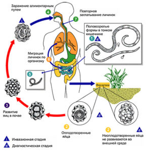 Форми і види аскаридоза аскариди в легенях, атипова локалізація