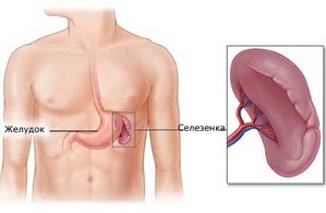 Де знаходиться селезінка у людини і від чого болить - симптоми і причини