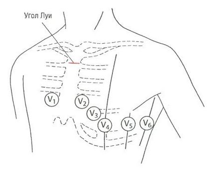 Sânul (precordial) conduce ekg