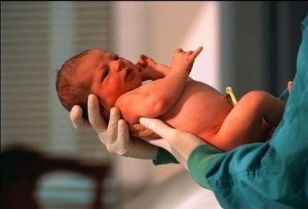 Imunitatea unui nou-născut și a caracteristicilor acestuia
