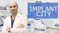 Expert implant - expert implant