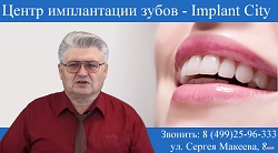 Expert implant - expert implant