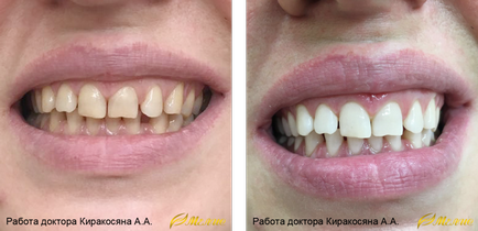 Cum se albesc dinții în centrul nostru, stomatologia din Zao, troparevo nikulino, în sud-vestul Moscovei