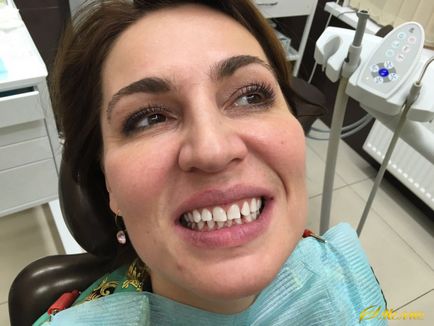 Cum se albesc dinții în centrul nostru, stomatologia din Zao, troparevo nikulino, în sud-vestul Moscovei