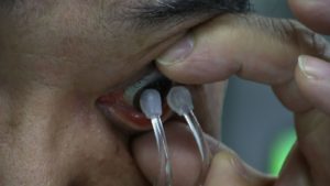 Як правильно знімати контактні лінзи з очей