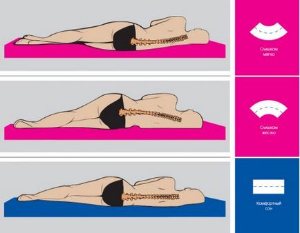Cum să dormi cu osteochondrosis poziții corecte pentru somn