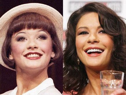 Як виглядали знамениті люди до і після брекетів