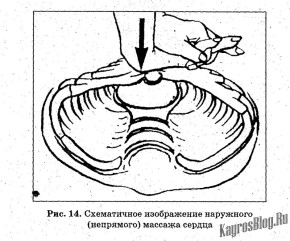 Як змусити серце працювати