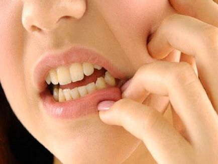 Gingival ciszta tünetei és okai A kezelés otthoni fotó