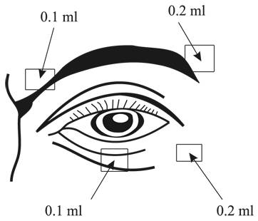 Diagnosticul spasmului hemifacial clonic, simptome, tratament