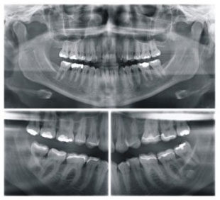 Комп'ютерна 3d томографія зубів і ортопанограмма - де зробити в Харкові