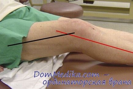Conturul articulației genunchiului