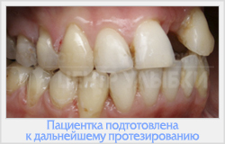 Корекція деформації щелеп і зубних дуг