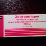 Ларингіт при вагітності причини, симптоми, лікування, можливі наслідки для жінки і дитини