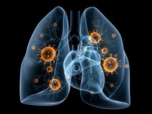Tratamentul pneumoniei focale și caracteristicile terapiei