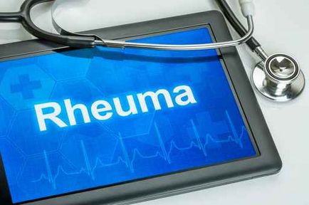 rheumatoid arthritis kezelésére - kezelés germánium - Ortopédia - a reumatoid arthritis kezelésére -