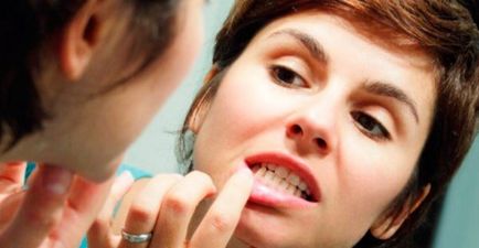 Tratamentul inflamației periostului dintelui